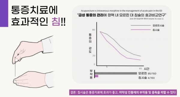 통증치료에 효과적인침.jpg